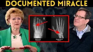 Woman INSTANTLY Healed From Multiple Sclerosis (Medically Documented)