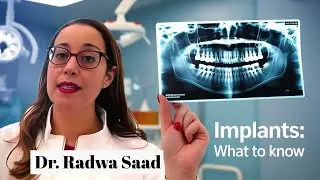 Dental Implants: what to expect before, during and after
