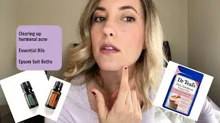 Hormonal Acne Hacks