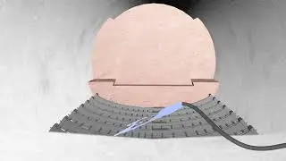 4 4 Ring Cut Method with Core Soil Reserve 1