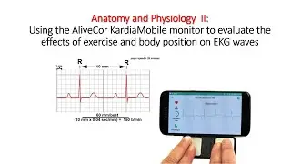 EKG  Lab: Using the AliveCor KardiaMobile monitor to evaluate the effects of exercise and body