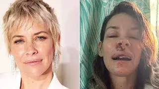 Evangeline Lilly breaks her silence about her brain injuries after an accident