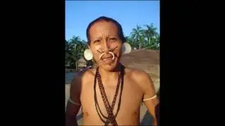 Regras Matis
