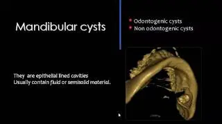 Imaging of Mandibular lesions Sep 2013   Dr Mamdouh Mahfouz In Arabic