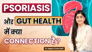 Psoriasis और Gut Health में क्या connection है ? | How to Keep Gut Healthy