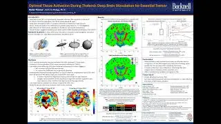 ThomasK - Optimal Tissue Activation During Thalamic Deep Brain Stimulation for Essential Tremor