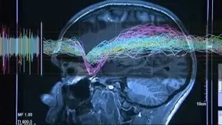 Those with 'Havana Syndrome' sound alarm, say Pentagon unit investigating mystery brain injury being