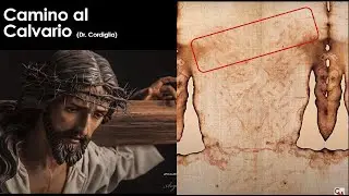 La sabana Santa: Ciencia y misterio 4. La crucifixión