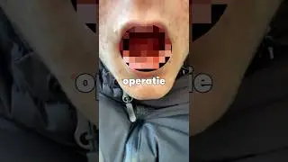 Deze operatie was heftig&hellip;😰