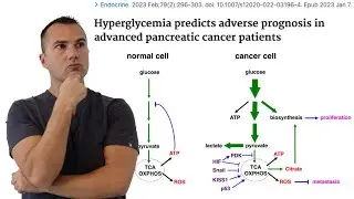 The Sugar-Cancer Connection You CANNOT Ignore