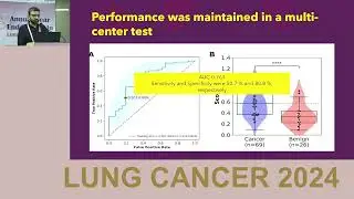 Non-Invasive Lung Nodule Diagnosis Using ctDNA Methylation | Multicenter Clinical Study Explained.