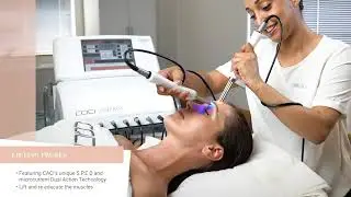 CACI Synergy Treatment Video!
