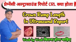 CRL Means in Pregnancy | CRL in Ultrasound report | Crown rump length | CRL report