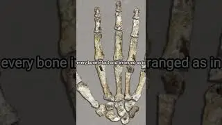 the mysterious bones
