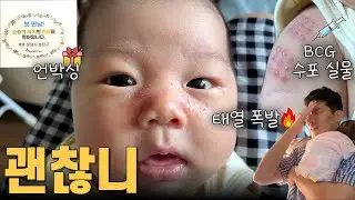 태열 터지고 손톱 사고😭 BCG 수포 이렇게 올라와요💉 CT 모유수유 괜찮을까? 분당 출산선물 언박싱🎁