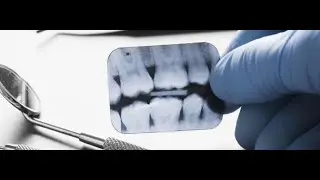 Dental Radiology Lecture 8. (Principles of Radiographic Interpretation)