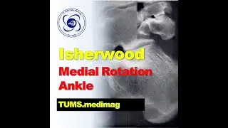 Medimag: Isherwood Method, Medial Rotation Ankle