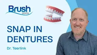 Brush Dental - Snap in Dentures - FAQs