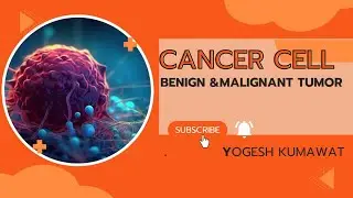 CLASS - 6    CANCER  TYPES OF CANCER , RADIOTHERAPY DEFINITION,  MALIGNANT TUMOR, BENIGN TUMORS