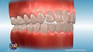 Intraoral