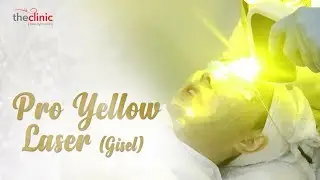 #TreatmentTheClinicID | Pro Yellow Laser - Gisella Anastasia