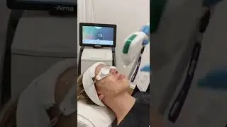 Luz Pulsada Harmony para manchas en el rostro y rejuvenecimiento facial en palermo Buenos Aires