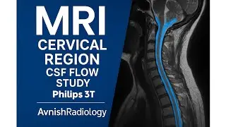 CSF Flow Study | Cervical Region MRI |3T@Philips @avnishradiology 