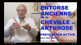 Vidéo Entorse de cheville ancienne ou récidivante : attention à l'arthrose ! par Guy Roulier