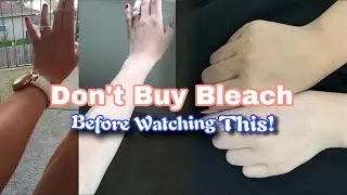 Best Bleach For Pimples & Clear Skin | Glow Guide By Aroosh 