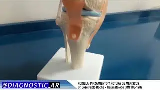 RODILLA PINZAMIENTO Y ROTURA DE MENISCOS