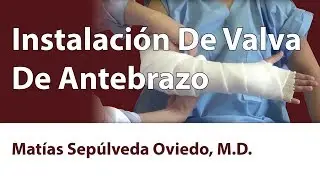 Instalación De Valva De Antebrazo