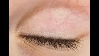 İnsan Derisi Hakkında En İlgin&ccedil; 10 Bilgi !!