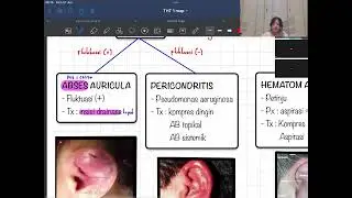 Copy of Mindmap Pagi Agustus 2024 - THT KL 1.mp4 [ukdi corner]