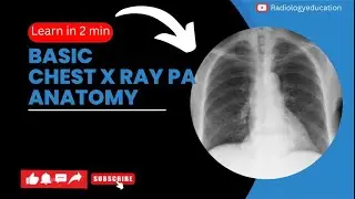 🤔Basic chest x ray pa view anatomy ?#radiology#chest#viralvideo#anatomy#xrays