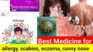 Acet tablet uses in bengali||Cetirizine hydrochloride 10mg||Benifits||dosage||side effects review