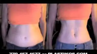 Plastikos MedSpa