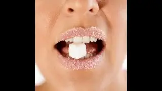 Effects of Sugar - Audley Dental