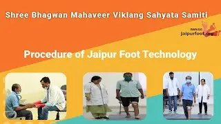 Crafting Personalized Prosthetic Limbs with Skill and Technology at BMVSS - JaipurFoot