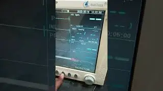 How to check nibp via Simulator