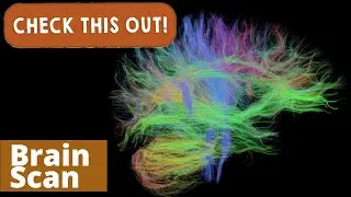 3D Brain Scan | Check This Out!