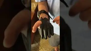 Bionic partial hand prosthesis || बायोनिक आंशिक हाथ कृत्रिम अंग  #naklihaath #prosthetichand #bionic