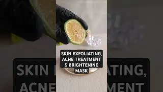 Home remedy to treat dull skin, acne treatment and uneven skintone #naturalskincare #skinbrightening