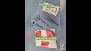 Cleft Lip Correction Demonstration