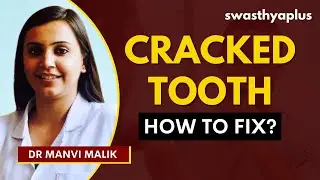Cracked Tooth Syndrome / Fractured Tooth | Symptoms & Treatment | Dr Manvi Malik