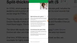Surgery:Types of Skin Grafts