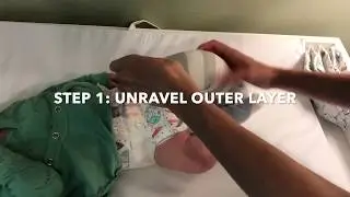 Clubfoot At Home Cast Removal