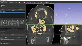 B4D Guide Module- 3d Slicer-Segmentations and Sinus Area