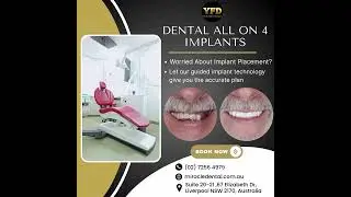 🦷✨ &ldquo;Missing multiple teeth? Tired of loose dentures?