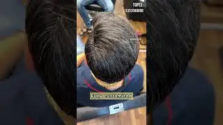 Custom hair systems in Bangalore| Salt & Pepper hair | Baldness solution for men| hair patch for men