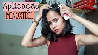 MINOXIDIL - Como faço aplicação